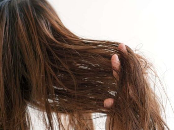 Pročitajte više o članku Tinejdžerka hospitalizirana nakon  što je pojela vlastitu kosu