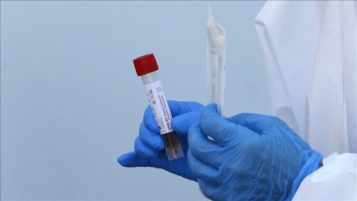 Pročitajte više o članku U Bosni i Hercegovini 617 novozaraženih koronavirusom, preminulo osam osoba
