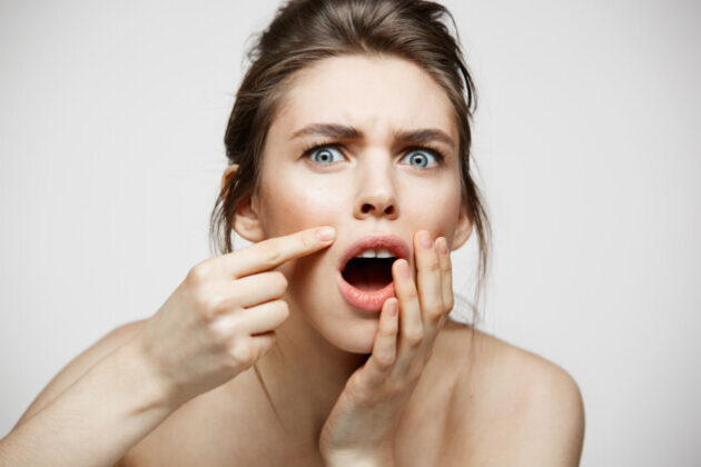 Pročitajte više o članku Kako spriječiti akne uzrokovane maskama za lice?
