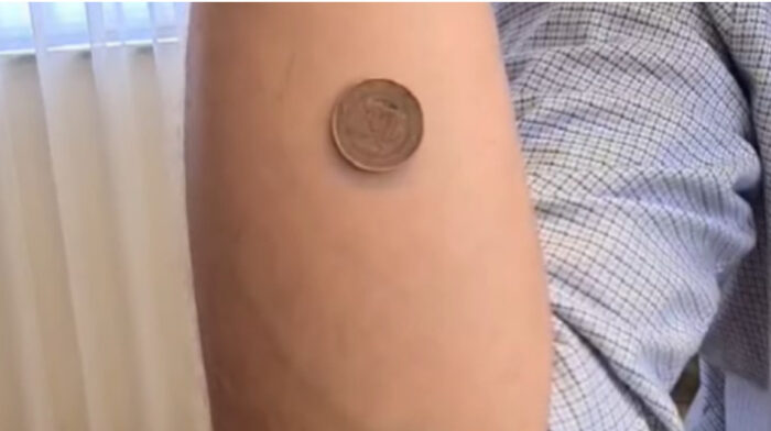 Pročitajte više o članku VIDEO – Začepio usta antivakserima: Rajčević objasnio zašto se novčić lijepi za ljudsko tijelo