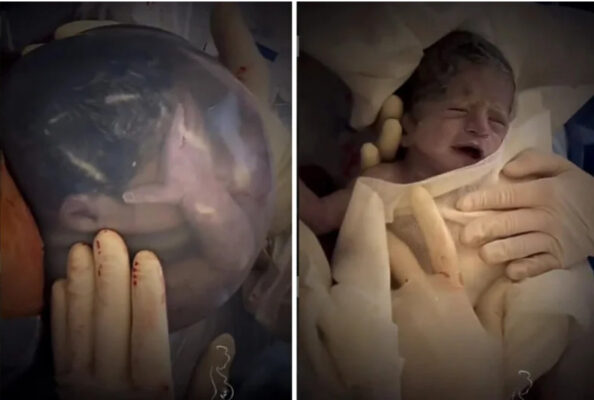 Pročitajte više o članku Pogledajte nevjerovatan prizor bebe rođene u vodenjaku koji je oduševio svijet