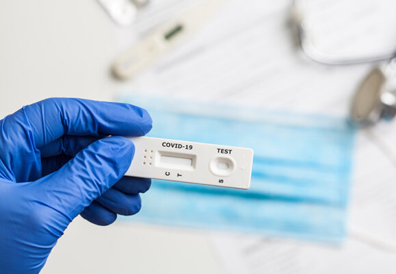 Pročitajte više o članku Koliko su pouzdani antigenski testovi iz apoteka?
