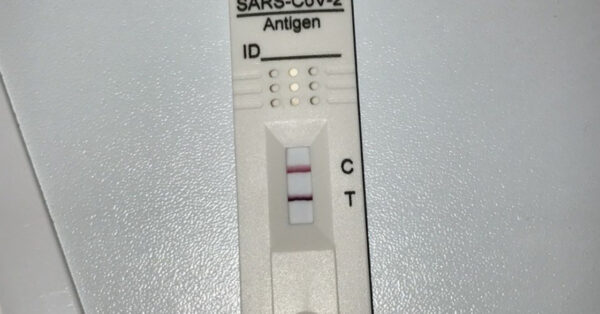 Pročitajte više o članku Kad se trebate testirati PCR-om, a kad brzim antigenskim?