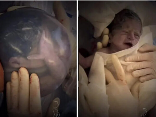 Pogledajte nevjerovatan prizor bebe rođene u vodenjaku koji je oduševio svijet