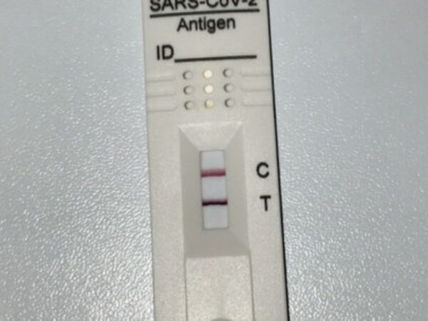 Kad se trebate testirati PCR-om, a kad brzim antigenskim?
